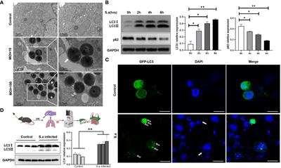 Eliminating the invading extracellular and intracellular FnBp+ bacteria from respiratory epithelial cells by autophagy mediated through FnBp-Fn-Integrin α5β1 axis